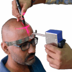 فوق تخصص کاشت مو در تهران