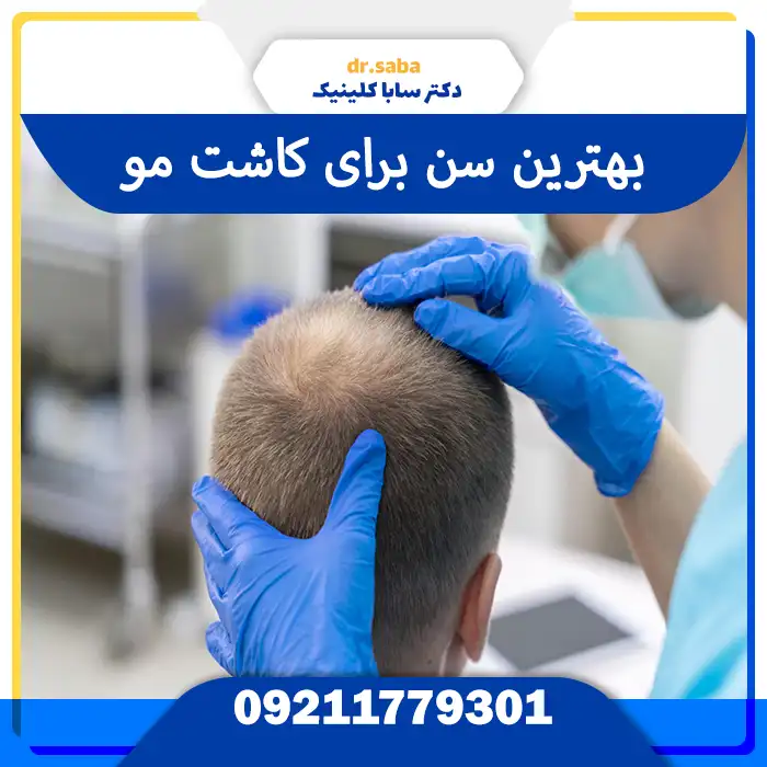 بهترین سن کاشت مو – تصویر گرافیکی از بازه سنی ایده‌آل برای بازسازی طبیعی موها