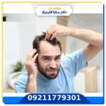 خطرناک ترین عوارض کاشت مو در مردان