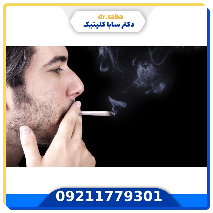 عوارض سیگار بعد از کاشت مو
