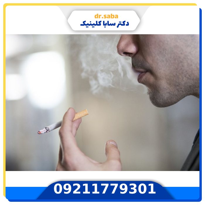 عوارض سیگار بعد از کاشت مو