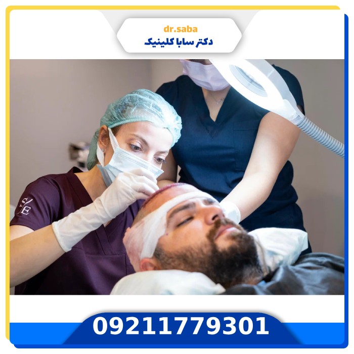هزینه کاشت مو با دستگاه اتوماتیک