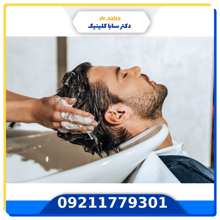 مراقبت های بعد از کاشت مو