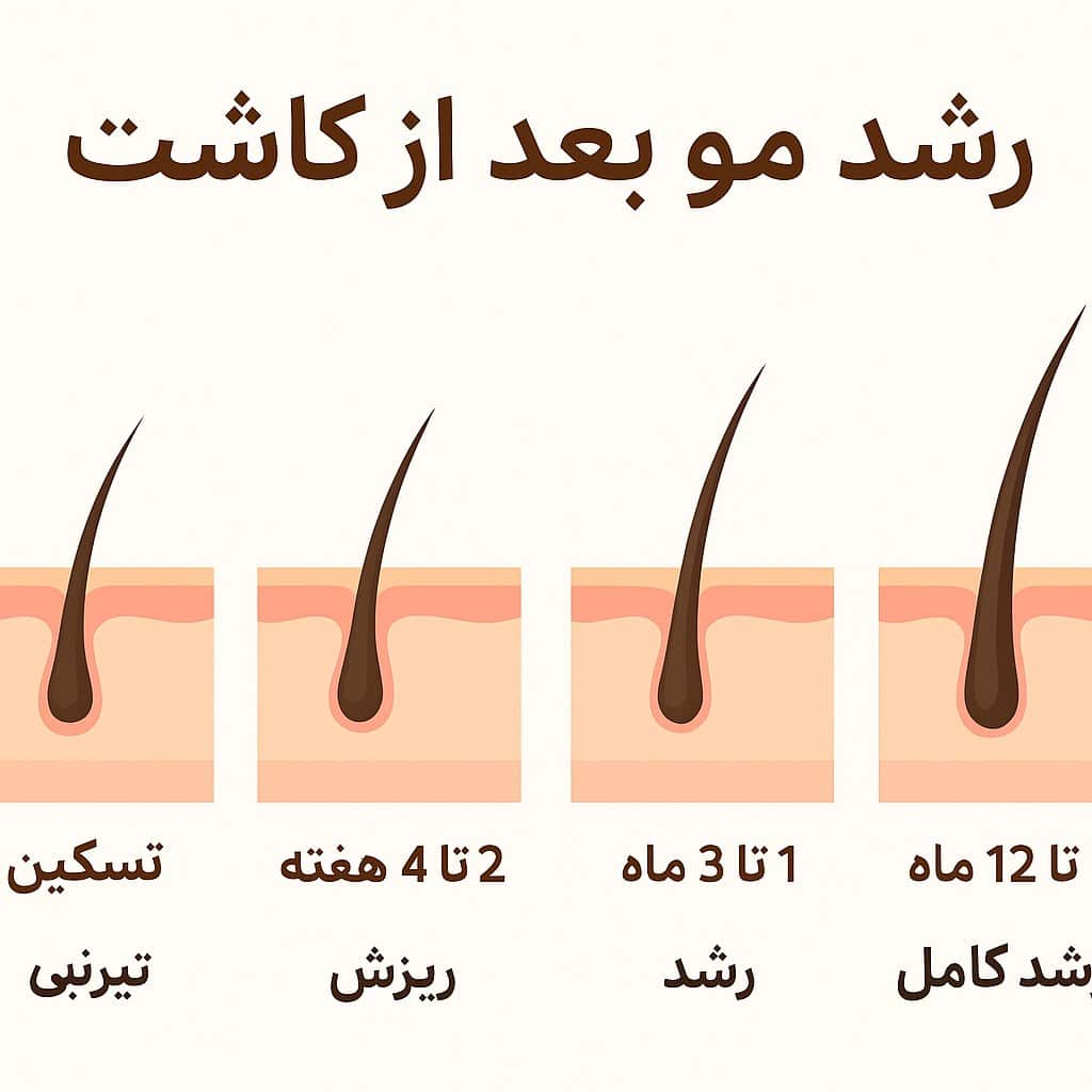 رشد مو بعد از کاشت