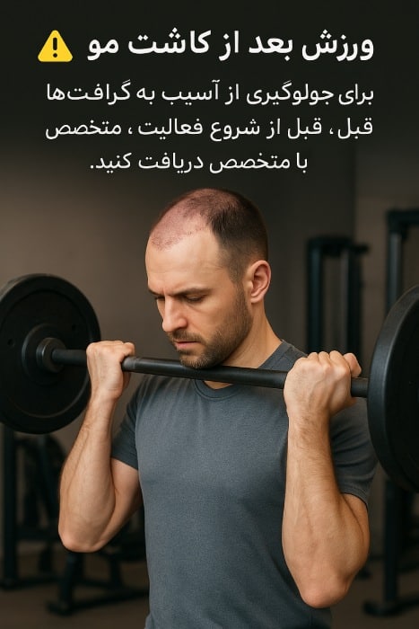 ورزش بعد از کاشت مو