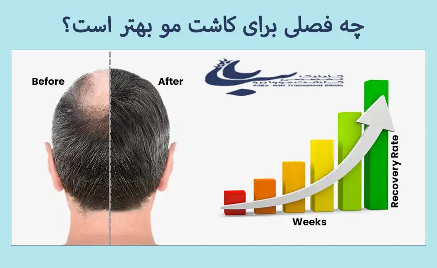 بهترین فصل برای کاشت مو