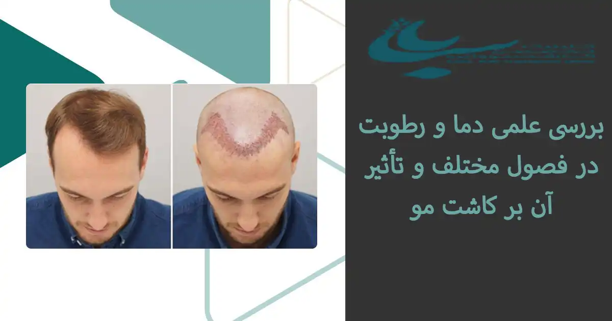 بهترین زمان برای کاشت مو در قصول مختلف