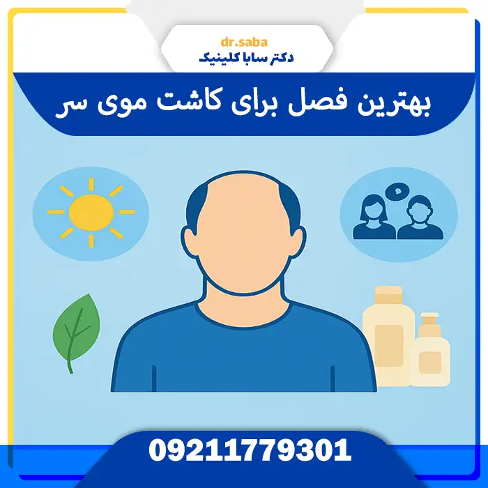 بهترین فصل برای کاشت موی سر 