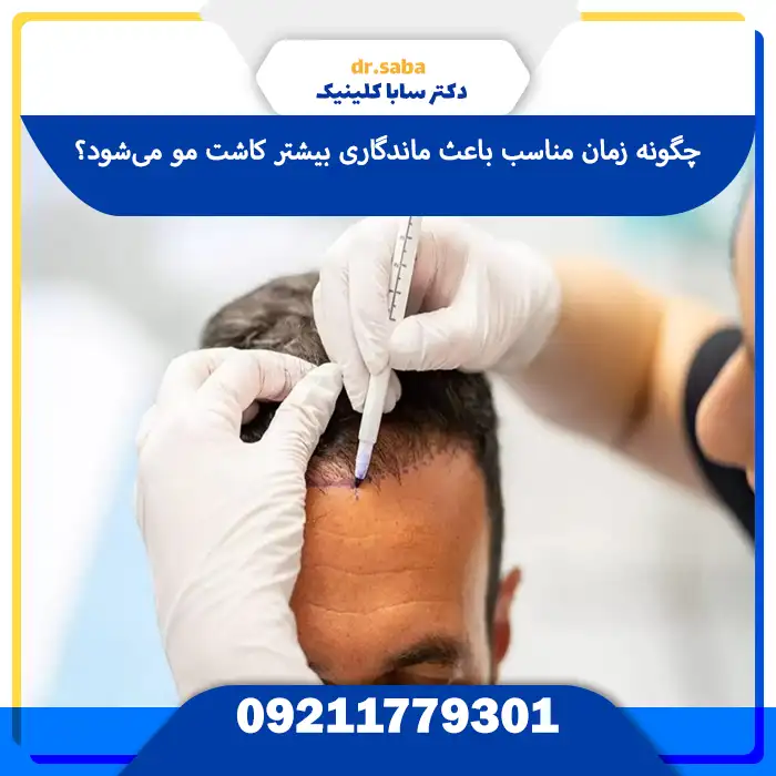 چگونه زمان مناسب باعث ماندگاری بیشتر کاشت مو می‌شود؟