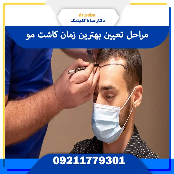 مراحل تعیین بهترین زمان کاشت مو