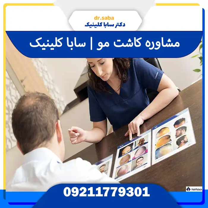 مشاوره کاشت مو در تهران