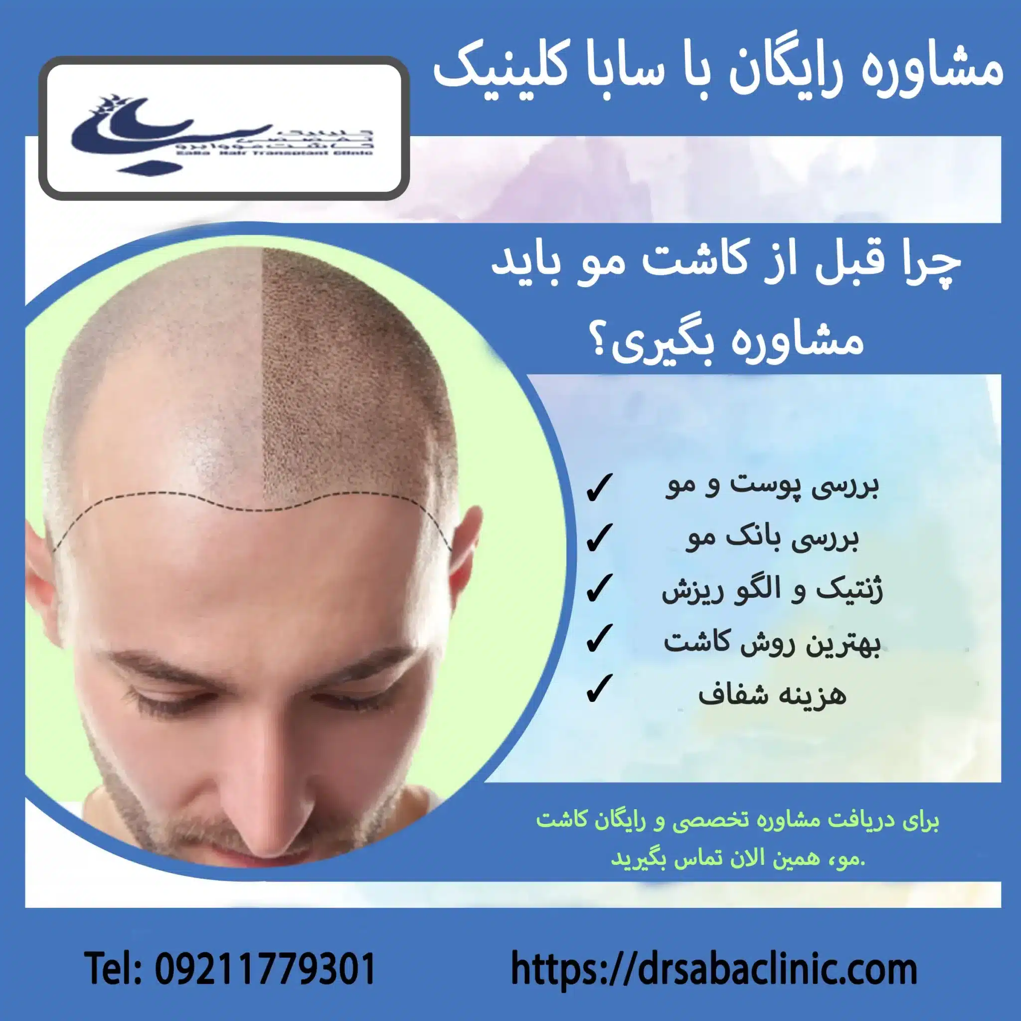مشاوره رایگان کاشت مو با سابا کلینیک