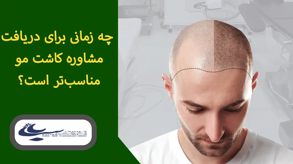 زمان مناسب دریافت مشاوره کاشت مو در تهران