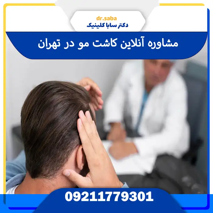 مشاوره کاشت مو آنلاین با سابا