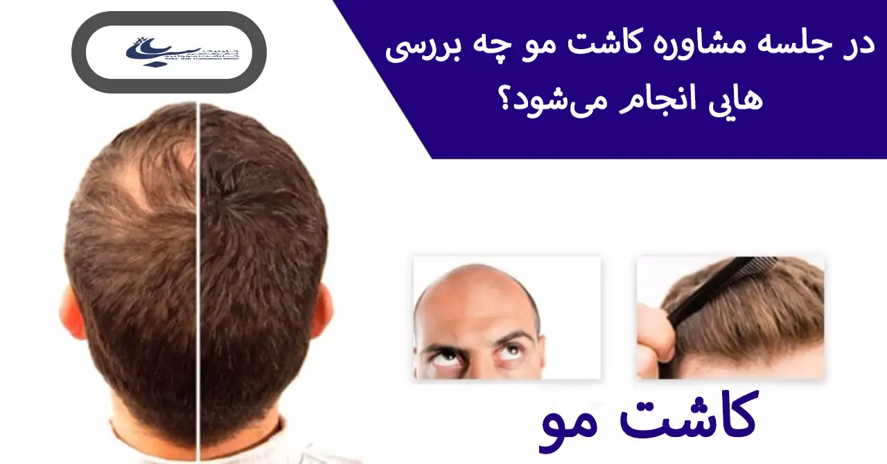 جلسات مشاوره کاشت مو