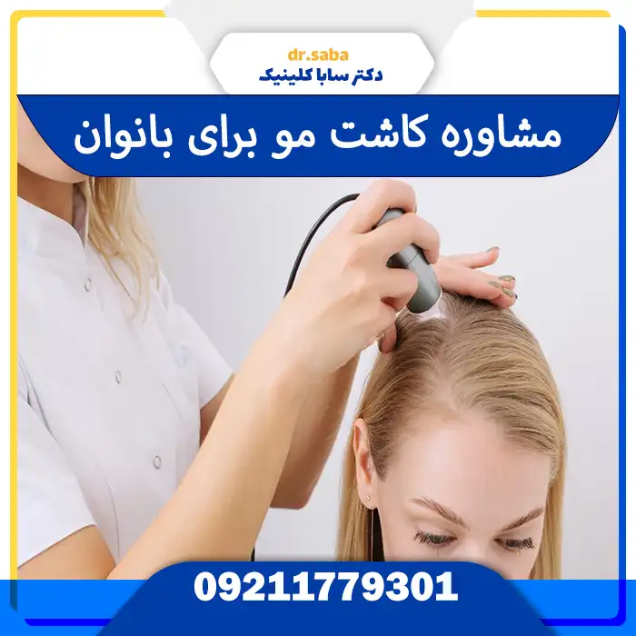 مشاوره کاشت مو برای زنان