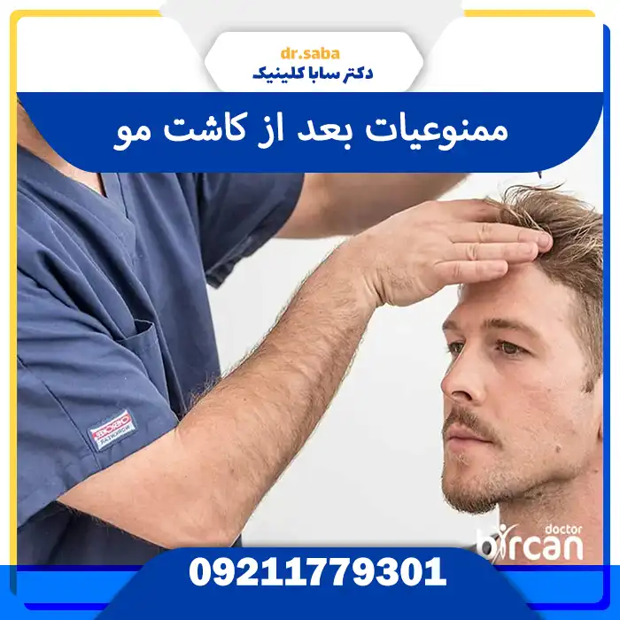 «ممنوعیات بعد از کاشت مو | کارهایی که نباید بعد از کاشت مو انجام دهید