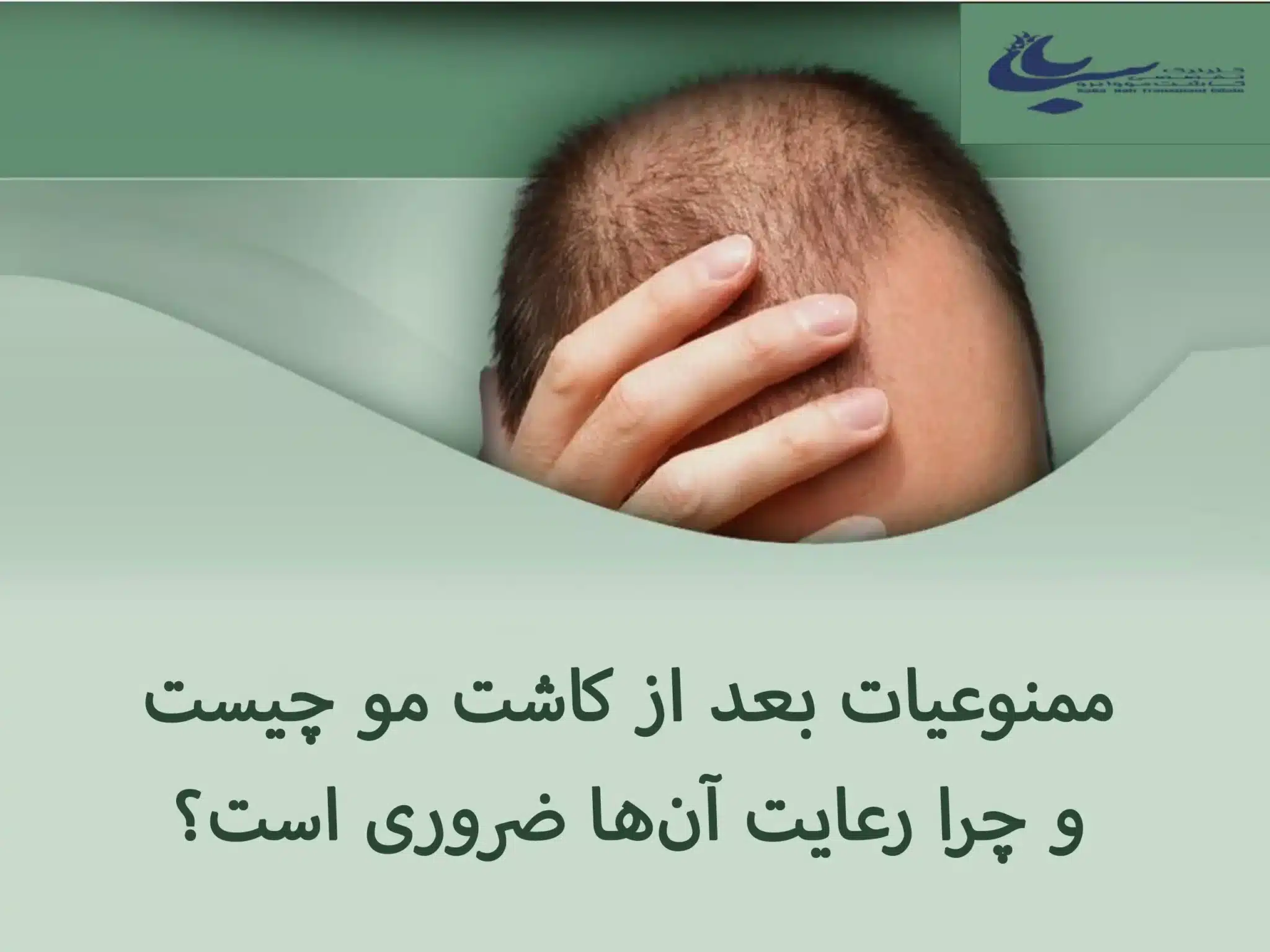 ممنوعیات بعد از کاشت مو 