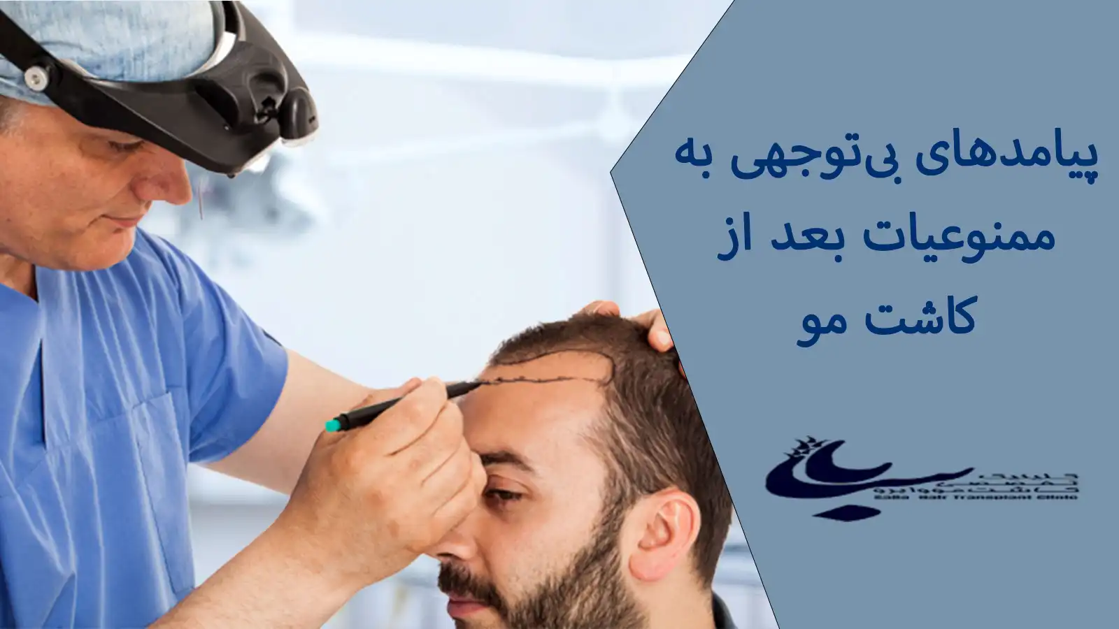 تصویر ممنوعیات بعد از کاشت مو