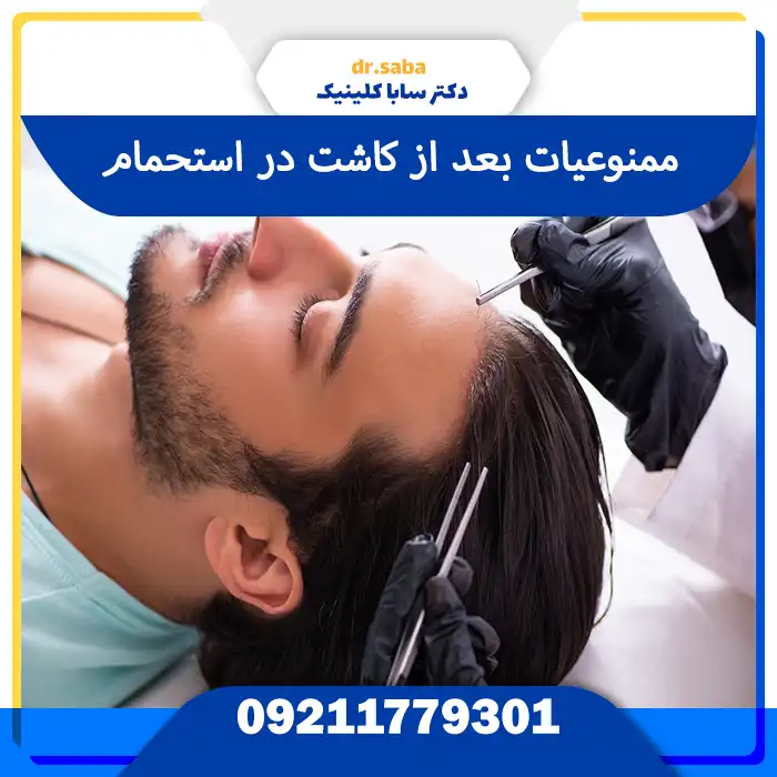 ممنوعیت در حمام کردن بعد از کاشت مو