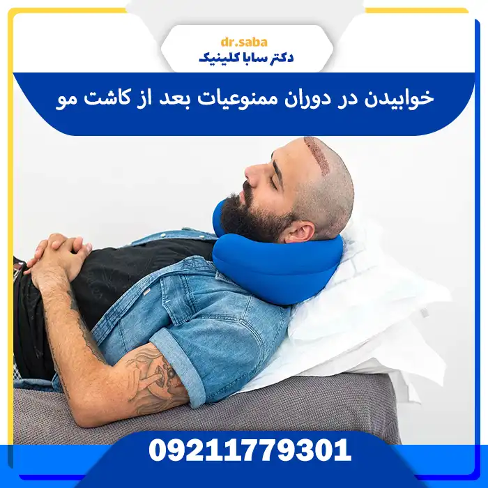 خوابیدن بعد از ممنوعیات بعد از کاشت مو