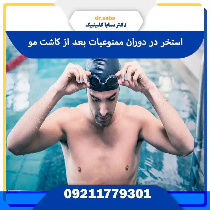 ممنوعیات بعد از کاشت مو 