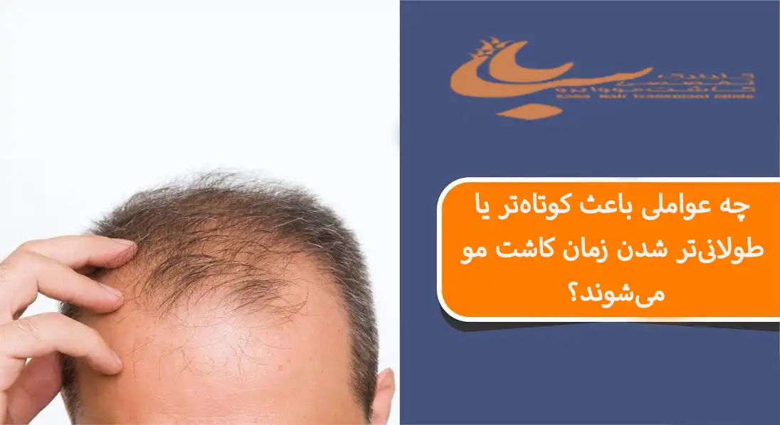 عوامل موثر بر مدت زمان کاشت مو