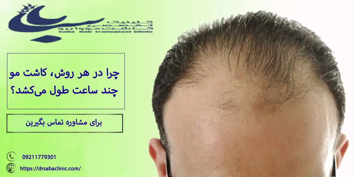 مدت زمان و هزینه کاشت مو