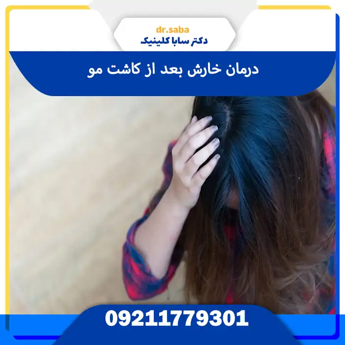 درمان خارش بعد از کاشت مو
