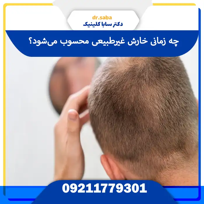 تصویر خارش بعد از کاشت مو