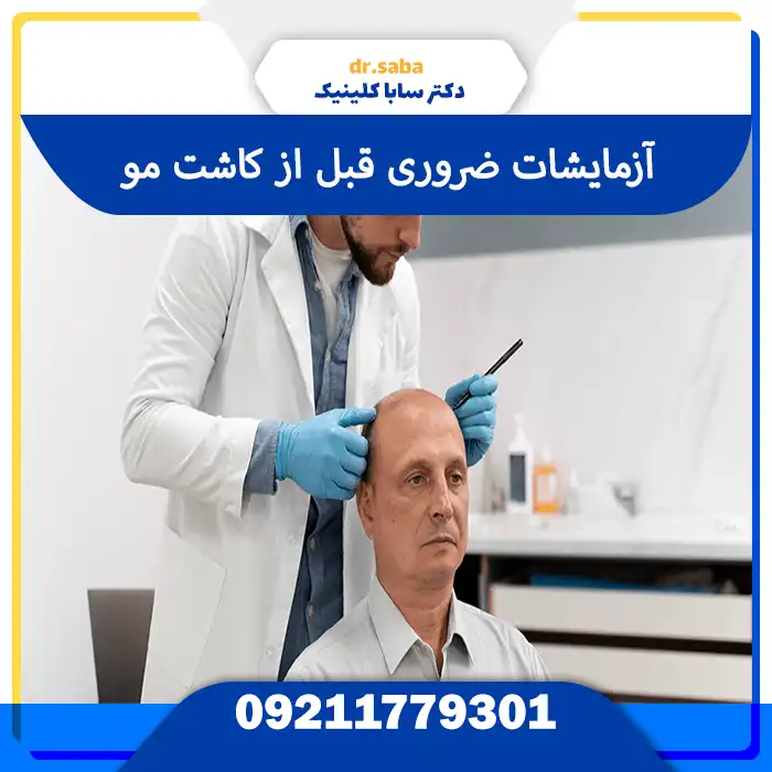 آزمایشات قبل از کاشت مو– بررسی سلامت بدن پیش از عمل برای کاشت موی طبیعی و ایمن