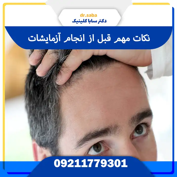 نکات مهم ازمایش های قبل از کاشت مو