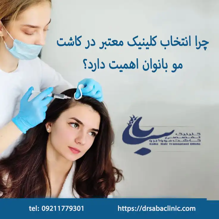 انتخاب کلینیک معتبر در کاشت مو بانوان