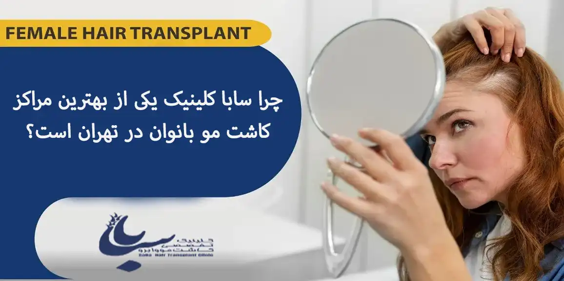 سابا بهترین کلینیک کاشت مو برای بانوان زیباجو