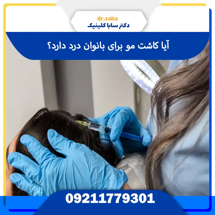 کاشت مو برای بانوان