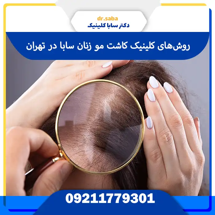 روش های کاشت نو در کلینیک کاشت مو بانوان