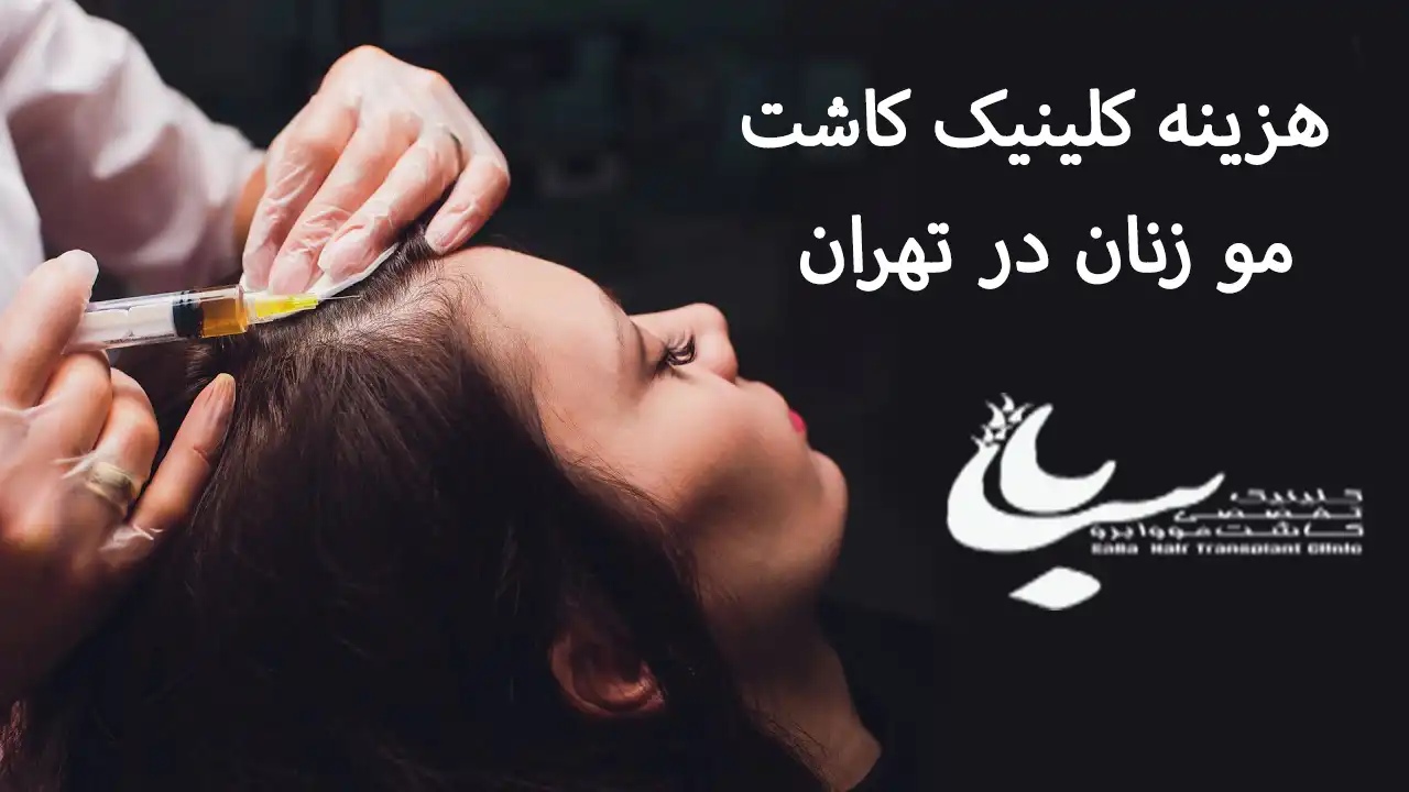 هزینه کلینیک کاشت مو بانوان در تهران