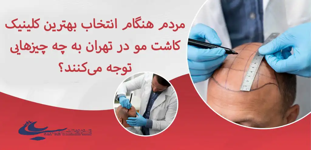 مقایسه تراکم مو قبل و بعد از عمل در بهترین کلینیک کاشت مو در تهران از نظر مردم
