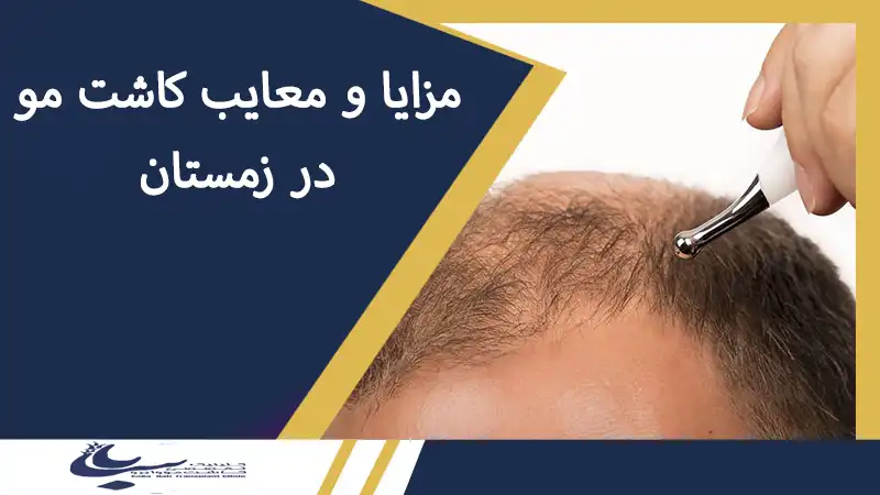 مزایا و معایب کاشت مو در فصول مختلف