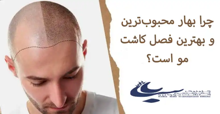 بهترین زمان و فصل برای کاشت مو