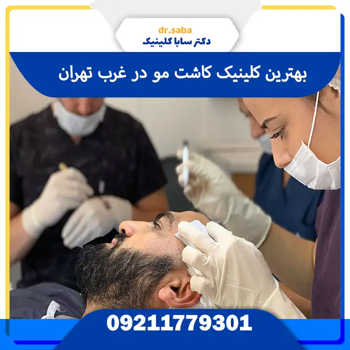 کلینیک کاشت مو در غرب تهران با تجهیزات مدرن