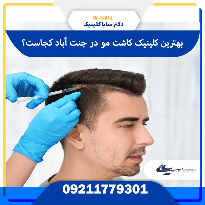 کلینیک کاشت مو در جنت آباد