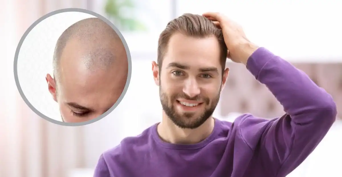 کلینیک کاشت مو در جنت‌آباد مرکزی