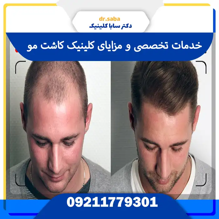کلینیک کاشت مو در جنت‌آباد مرکزی