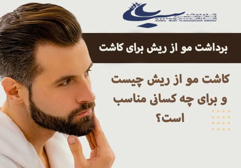 کاشت مو از ریش چیست و برای چه کسانی مناسب است؟