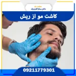 کاشت مو از ریش توسط پزشک متخصص در سابا کلینیک
