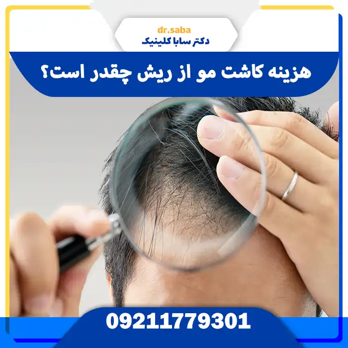 هزینه کاشت مو از ریش چقدر است؟