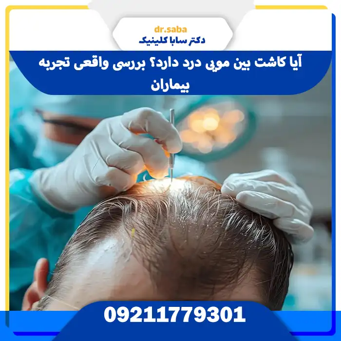 آیا کاشت بین مویی درد دارد؟ 