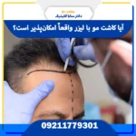 کاشت مو با لیزر در مقایسه با روش‌های FUE و FUT | بررسی تفاوت، هزینه و نتایج نهایی