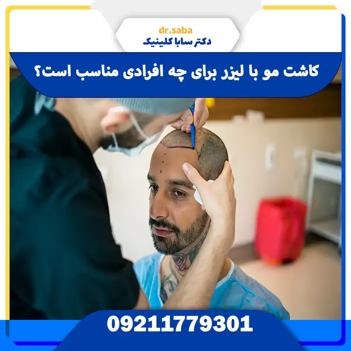 کاشت مو با لیزر برای چه افرادی مناسب است؟